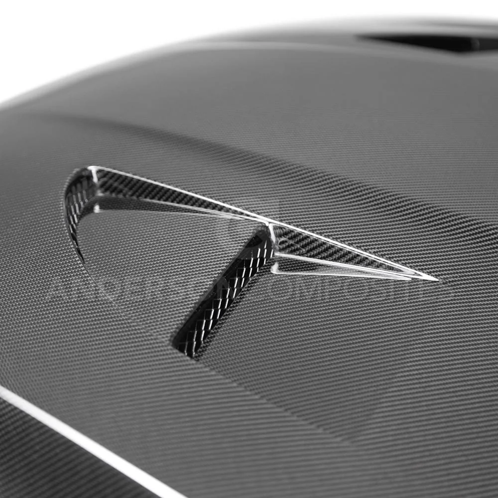 Anderson Composites MK3 Ford Focus Carbon Fiber Type SA Hood 2015-18 - Image 5